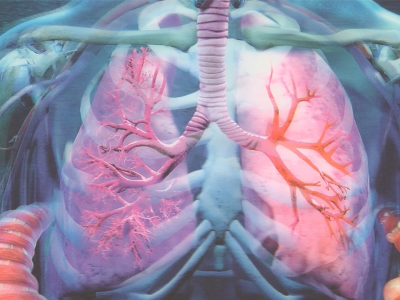 biopsias pulmonares