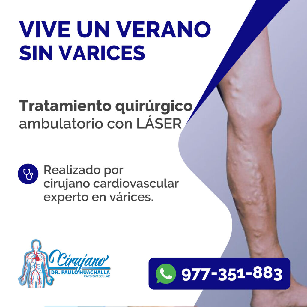 ¿A qué se dedica un cirujano cardiovascular?