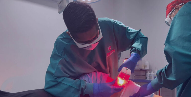 tratamiento de varices con cryolaser