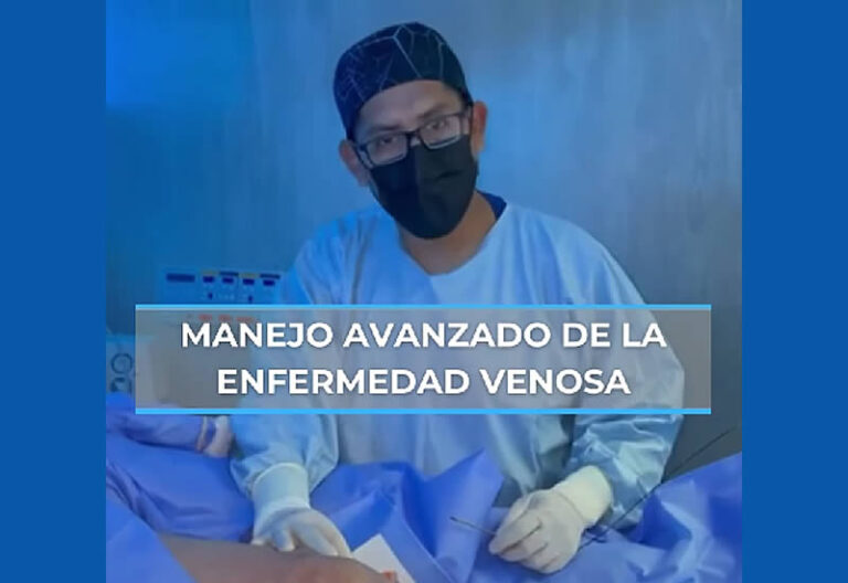 manejo avanzado de la enfermedad venosa, tratamiento para varices