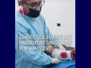 que hacer si presentas varicorragia o sangrado por varices