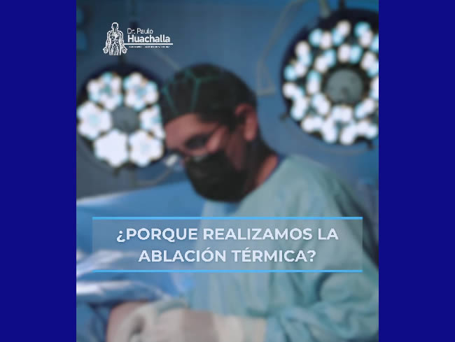 tratamiento de ablacion termica