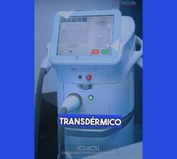 Tratamiento de Arañitas Vasculares (Telangiectasias) con la Mejor Tecnología – CLaCS Tratamiento de Arañitas Vasculares (Telangiectasias) con la Mejor Tecnología – CLaCS