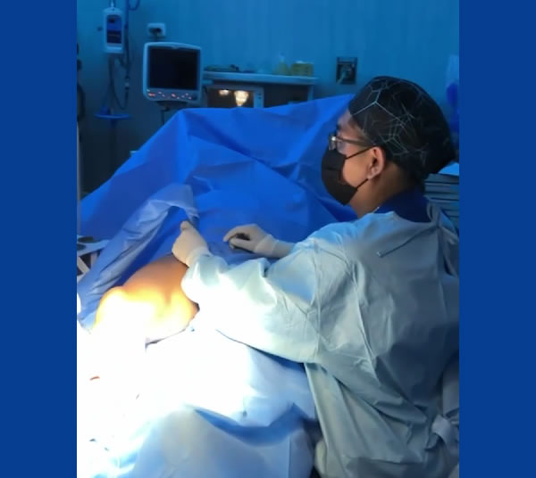 Ablación endovascular con láser de última generación Ablación endovascular con láser de última generación