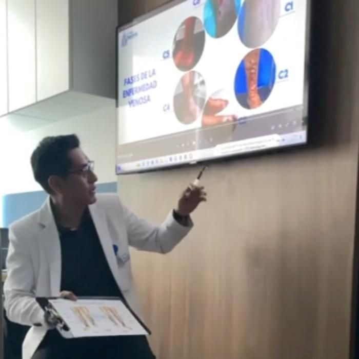 porque la escleroterapia no aplica a todo tipo de varices