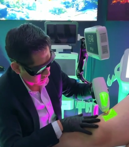 tratamiento de arañitas vasculares