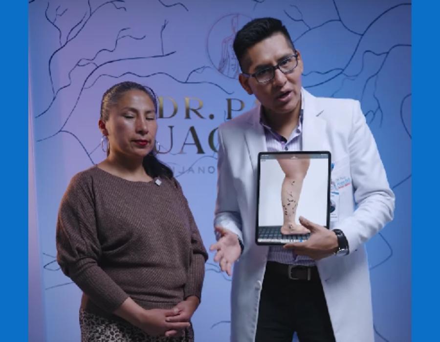 testimonio de paciente que viene desde cusco a tratar sus varices