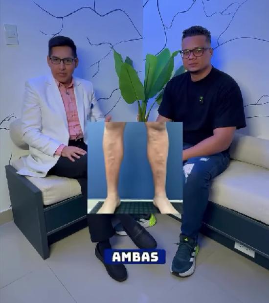 tratamiento para varices con resultados positivos