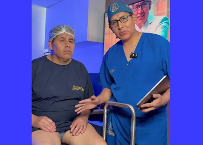 ablacion quimica para varices