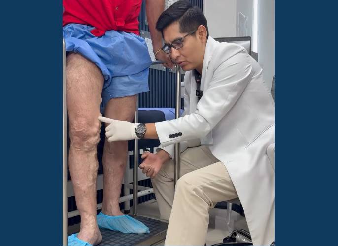 doctor de varices en el peru